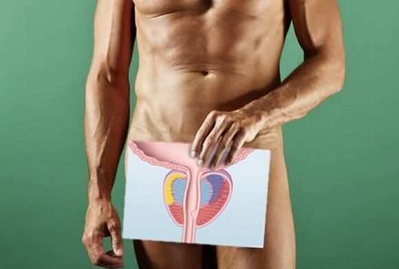 A man suffering from prostatitis